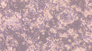 Mechanisms and Applications of Conditional Reprogramming Technology