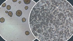 NeuroCult™ Proliferation Media