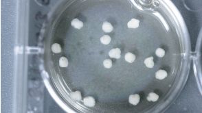 How to Grow Cerebral Organoids from Human Pluripotent Stem Cells