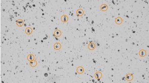 How to Count Intestinal Crypts for Mouse Organoid Cultures