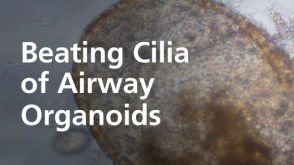 Beating Cilia of Airway Organoids Grown in PneumaCult™