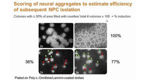 Tired of Manual Neural Rosette Isolation? How to Form and Isolate More Efficiently