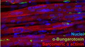 3D Modeling of Skeletal Muscle for In Vitro Functional Assaying