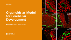 Virtual STEMCELL Seminar: Organoids as Models for Cerebellar Development