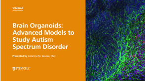 Brain Organoids: Advanced Models to Explore Autism Spectrum Disorder
