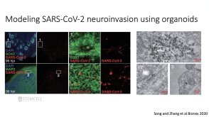 Exploring the Impact of SARS-CoV-2 Infection on the Central Nervous System
