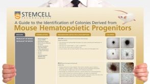 Identification of Colonies Derived from Mouse Hematopoietic Progenitors