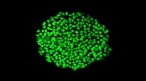 Feeder-Independent Culture of hESCs and hiPSCs with mTeSR™1