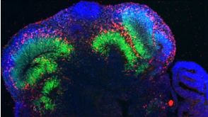 Madeline Lancaster on Brain Organoids: Modeling Human Brain Development in a Dish