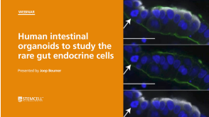 Organoid Mini-Symposium: Human Intestinal Organoids to Study Rare Gut Endocrine Cells