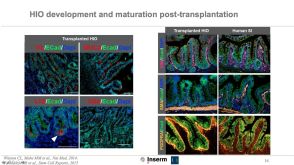 Virtual STEMCELL Seminar: From iPSCs to Intestinal Organoids: Toward Complex Tissue Engineering