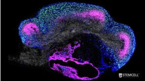 Mini-Symposium: The Evolution and Application of Brain Organoids to Study Human Disease