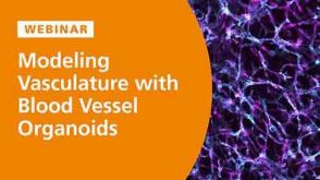 Modeling the Structural and Functional Features of Blood Vasculature with Blood Vessel Organoids