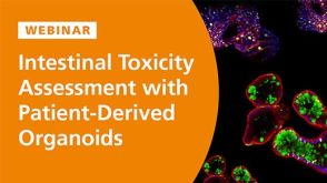 Intestinal Toxicity Assessment with Patient-Derived Organoids