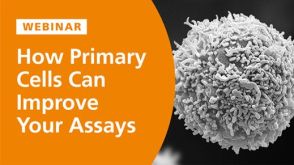 How Primary Cells Can Improve Your Cell-Based Assays