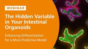 The Hidden Variable in Your Intestinal Organoids