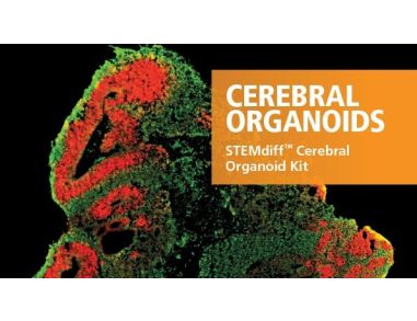 STEMdiff™ Cerebral Organoid Kit
