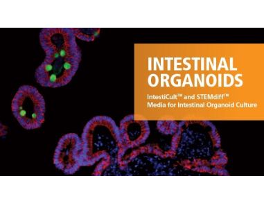 Intestinal Organoids