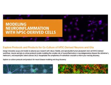Modeling Neuroinflammation with hPSC-Derived Cells