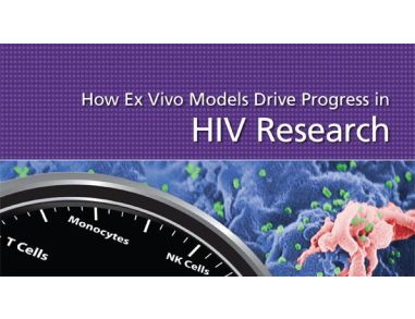 How Ex Vivo Models Drive Progress in HIV Research