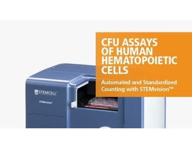 STEMvision™ Automated and Standardized Counting of CFU Assays of Human Hematopoietic Cells