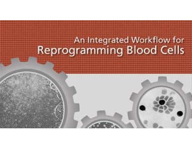 An Integrated Workflow for Reprogramming Blood Cells