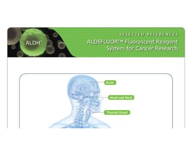 ALDEFLUOR™ Selected Cancer References