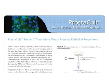 ProstaCult&trade;: Detect 7 Times More Mouse Prostate Epithelial Progenitors