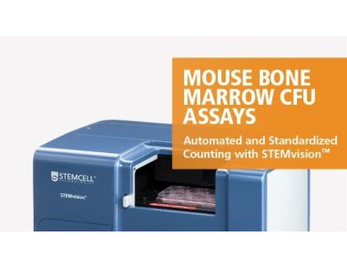 STEMvision™ Automated and Standardized Counting of Mouse Bone Marrow CFU Assays