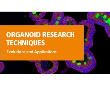 Organoid Research Techniques: Evolution and Applications