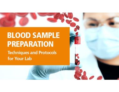 Blood Sample Preparation