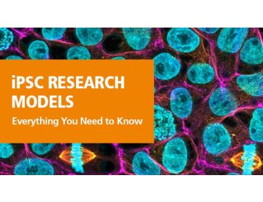 Induced Pluripotent Stem Cells as Accessible and Standard Research Models