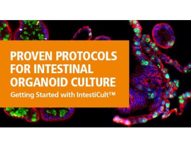 Proven Protocols for Intestinal Organoid Culture: Getting Started with IntestiCult™