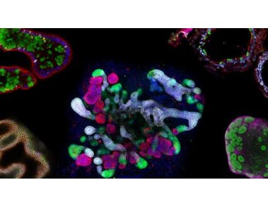 The Predictive Power of Organoids in Drug Discovery