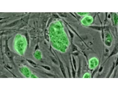 STEMCELL Technologies Inc. has just released NEW MesenCult™ Proliferation Kit with MesenPure™ (Mouse), a novel cell culture medium to advance research on mouse mesenchymal stem and progenitor cells (MSCs)