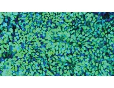 STEMCELL Technologies Applauds Feeder-free Derivation of Human Induced Pluripotent Stem Cells