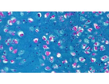 STEMCELL Technologies Introduces a New Animal Component-Free, Serum-Free Medium for Culturing Human Mesenchymal Stem Cells
