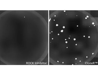 STEMCELL Technologies to Launch CloneR™ to Facilitate Genome Editing of  Human Pluripotent Stem Cells