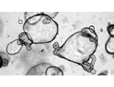 STEMCELL Technologies Brings Groundbreaking Intestinal and Brain Organoid Culture Tools to the Global Research Community