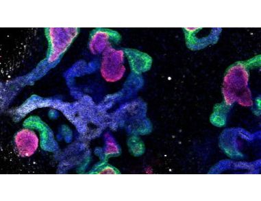 STEMCELL Technologies Signs Exclusive License to Commercialize Human Pluripotent Stem Cell-Derived Kidney Organoid Culture System