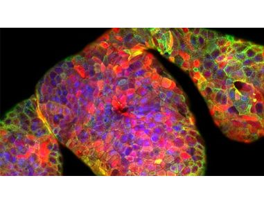 CRISPR-Cas9 Genome Editing of Human Liver Organoids