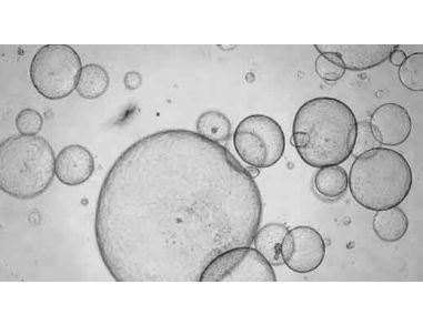 How to Process Epithelial Organoids and Organoid-Derived Epithelial Monolayers for RNA Isolation