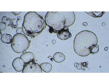 How to Perform Cytotoxicity Screening Using Hepatic Organoids Cultured in HepatiCult™ (Human)