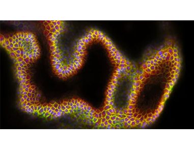 How to Establish, Expand, and Cryopreserve hPSC-Derived Liver Organoids