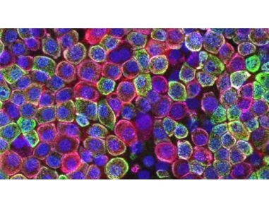 How to Generate Alveolar Monolayers from ATII Organoids
