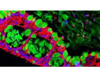 Barrier Permeability Assay Using Human Intestinal Organoid-Derived Monolayers
