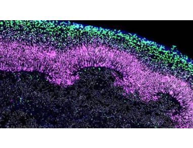 Cryogenic Tissue Processing and Section Immunofluorescence of Neural Organoids