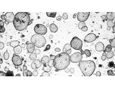 Toxicity Testing for Drug Development Using Human Intestinal Organoids and IntestiCult™