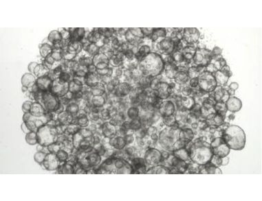 Passaging Intestinal Organoids into Suspension Culture Using IntestiCult™