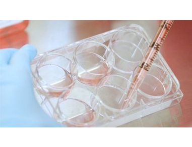 How to Generate Monocyte-Derived Dendritic Cells